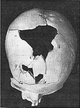 Останки черепа